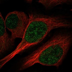 PCBD1 Antibody, Novus Biologicals 0.1mL; Unlabeled:Antibodies, Polyclonal